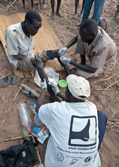 , South Sudan harbors the vast majority of the world’s remaining cases of Guinea worm disease: Today, South Sudan harbors the vast majority of the world’s remaining cases of Guinea worm disease, which can incapacitate patients for weeks as a worm painfully emerges from a lesion on the skin. In February 2010, Dario Mere (above) suffered worms emerging from both his legs and received free Carter Center-supported treatment and health education at his home in Terakeka County, South Sudan from trained health workers and volunteers. Photograph courtesy of The Carter Center/ L. Gubb